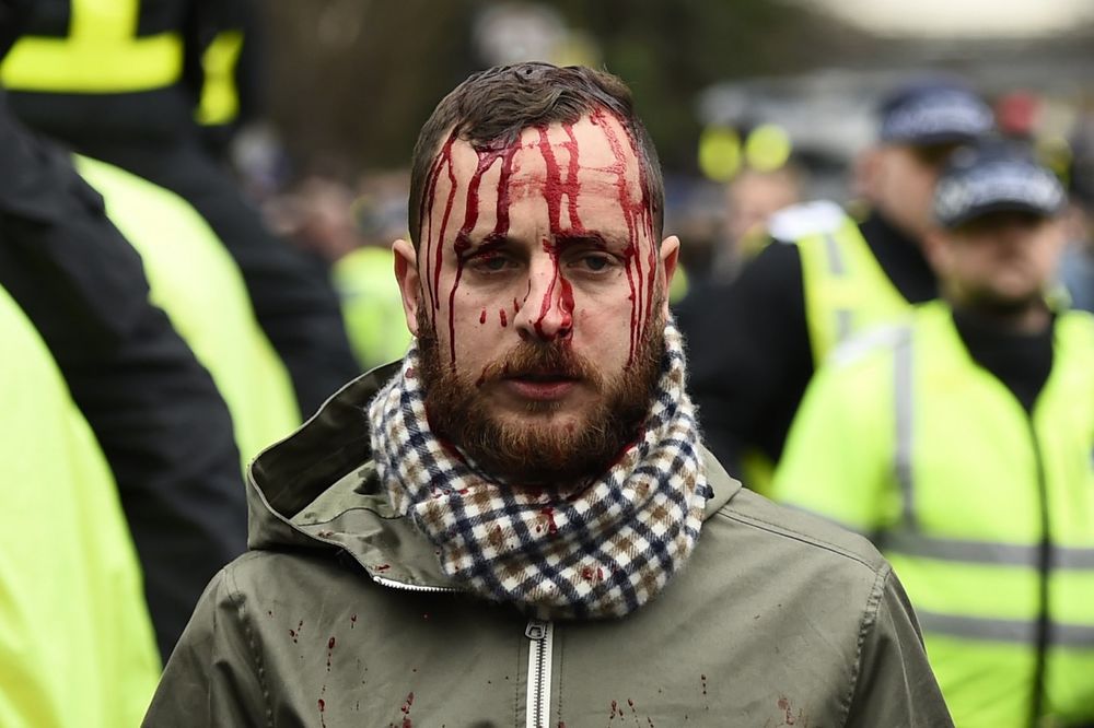 (VIDEO) KRV TEČE LONDONOM: Navijači Totenhema i Arsenala sukobili se pre meča