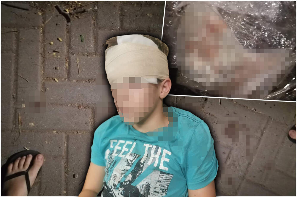 UŽAS U PANČEVU! DRUG UMOTAO DEČAKU (13) GLAVU U FOLIJU I SNIMAO ZA TIKTOK! Majka uznemirena: Zamalo dete da mi umre...