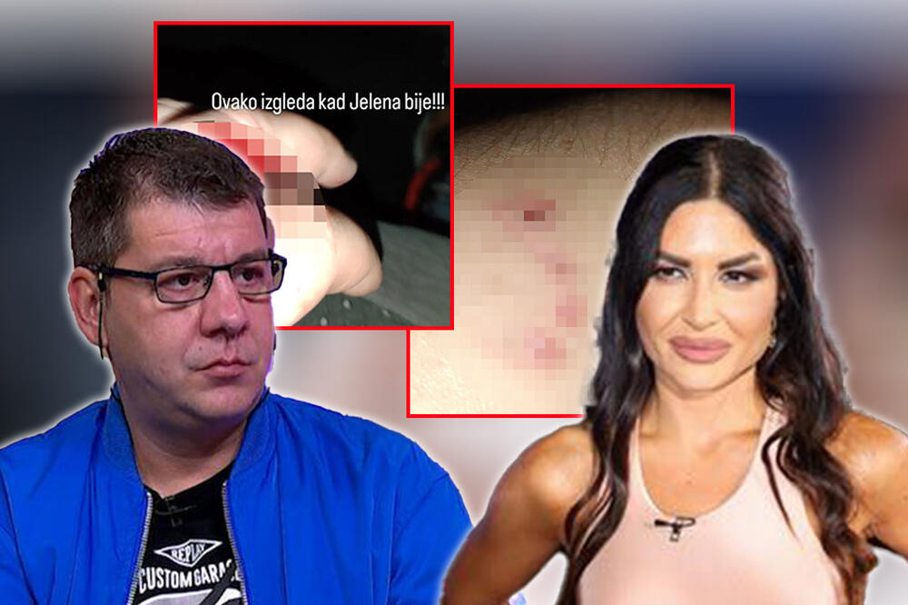 "OVAKO IZGLEDA KADA JELENA BIJE" Ivan Marinković objavio uznemirujuće fotografije, tvrdi da mu je rane nanela bivša žena